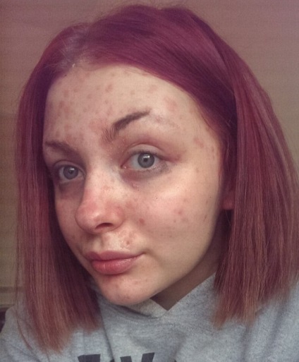 Machiajul - o salvare de la boala psoriazisului a determinat-o pe fata să stăpânească profesia de make-up artist