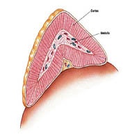 Umflarea mucoepidermoidului a glandei salivare