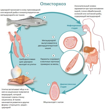 Opisthorchiasis - mi az, és hogyan kell kezelni