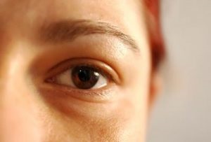 Osteocondroza și umflarea ochilor ca fiind asociate, tratament