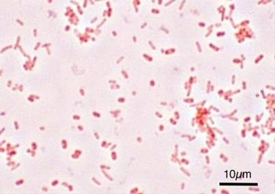 Diagnosticul intestinal acut online, semne, prognostic