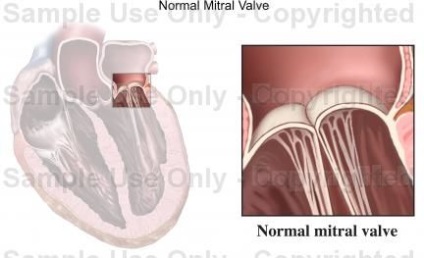 Diagnosticarea prolapsului valvei mitrale