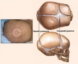 Rodnichok la nou-născuți, care ar trebui să fie fontanelul nou-născutului