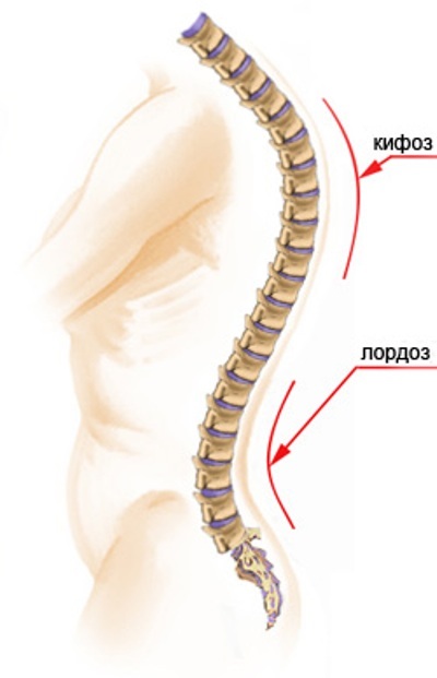 Simptomele și diagnosticul lordozelor