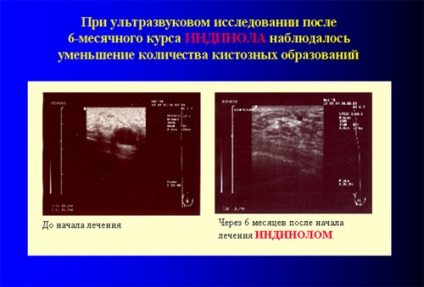 Direcționarea terapiei bolilor proliferative ale sistemului reproducător - articole - portal medical