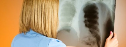 Tuberculoza și tratamentul acesteia