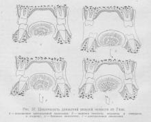 Unghiul articulației transversale (unghiul benietului), stomatologia ortopedică