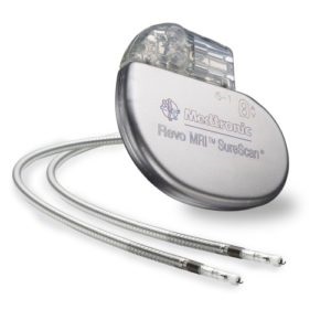 Instalația stimulatorului cardiac - funcționarea și contraindicațiile după vârstă