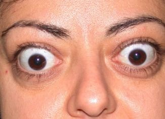 Tratamentul chirurgical al exophthalmosului tiroidian