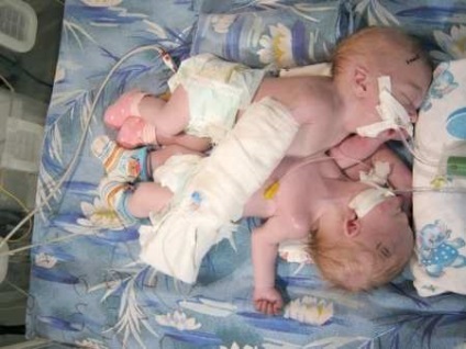 Moașele au fost șocate când au văzut cine naște această femeie! (Fotografii) - știri pline de farmec