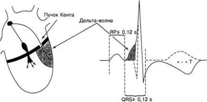 Anatomia sistemului de conducere și electrofiziologia inimii - diagnosticarea și tratamentul tulburărilor de ritm