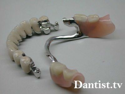 Prelucrați protezele dentare detașabile, tipurile și fotografiile