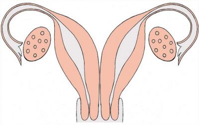 Două uterine la femei provoacă și pericol, dublare și sarcină