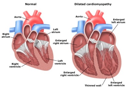 Ekg, partea 3b