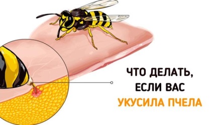 Dacă ați fost mușcați de o albină ... este important să cunoașteți pe toată lumea