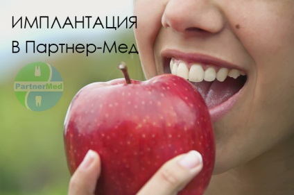 Implantarea tipurilor de dinți și a prețurilor în reduceri Volgograd