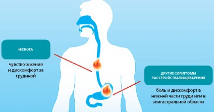 Arsuri la stomac - care sunt cauzele, simptomele, care este motivul fabricii farmaceutice din Rostov