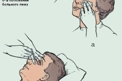 Cum să insuflați picături oftalmice
