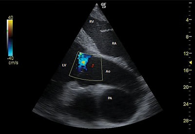 Caz clinic al edemului pulmonar cardiogen în cal - oraș zooinform