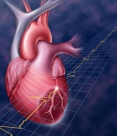 Angiografia coronariană și ventriculografia - informații despre sănătate