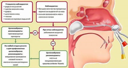 Tratamentul rinitei la adulți vasomotor, alergic, cronic, acut, atrofic