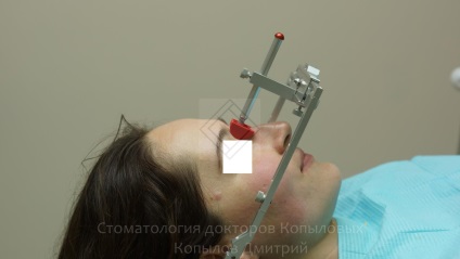 Tratamentul de abraziune a dintilor - stomatologie a medicilor kopylovyh