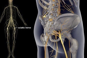 Tratamentul apăsării semnelor nervoase sciatice ale bolii