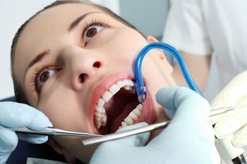 Stomatologie din carii dentare și canalele dentare în Kharkiv