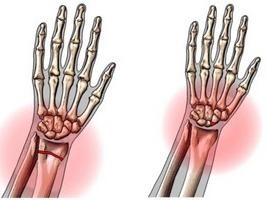 Radial Bone