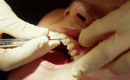 Fie că este posibilă tratarea unui dinți la hrănirea toracală a revoluției copil-modx