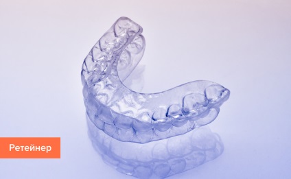 Dinți ortodontici pentru dinți