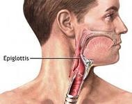 Tratamentul cu epiglotita acuta, simptomele, complicatiile