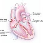 Elsősegély a tachycardia számára