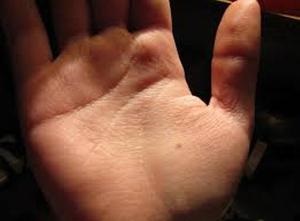 Születés a jobb kéz tenyerén, jelentése és hogyan kezeli a kéztisztaságot
