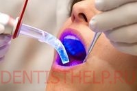 Plăci dentare moderne; închidere ușoară - instalare; pentru a pune un sigiliu ușor pe dinții din față