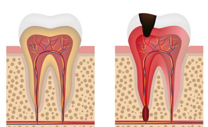 A gyökérciszta kezelésére fordított költségek, a megjelenés okai, a fénykép, a ciszták kezelése, a Rostov-on-Don