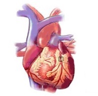 Cursul de ateroscleroză este tratamentul inimii