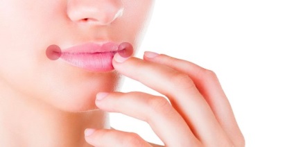 Fisuri în colțurile buzelor cauze și tratament, prevenire