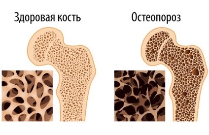 Urinoterapia cu pancreatită care sunt beneficiile și efectele secundare - trăiesc sănătoși