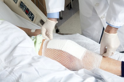 Îngrijirea înfundării după înlocuirea protezei genunchiului