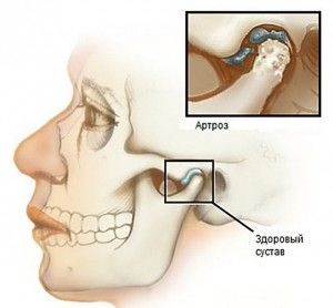 Articulația temporomandibulară și structura sa