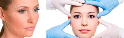 Acupunctura faciala efecte chirurgicale, rezultate, efect de la aqualift
