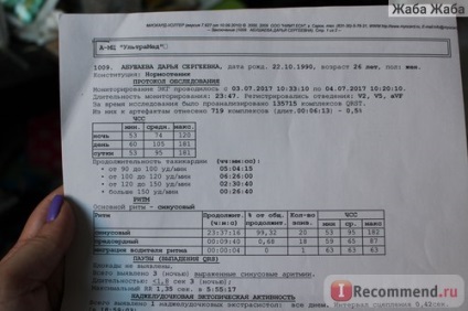 Holter monitorozása az ecg - 