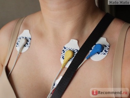 Holter monitorozása az ecg - 