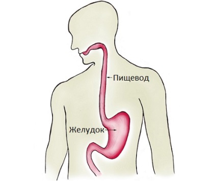 Etiologia esofagitei de reflux cronică și variabilitatea tratamentului