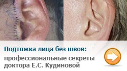 Gratuit piept de plastic și facial lipofilling la doctor saruhanov
