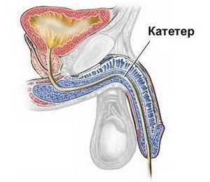 Cystografie, urologul meu