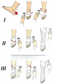 Bandaje elastice pentru varice ca bandaj