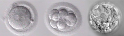 Embrion sau blastocist ca să aleagă