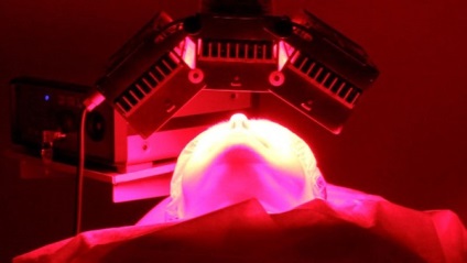 Terapia fotodinamică a bolilor organelor ORL; tratament modern cu fdt